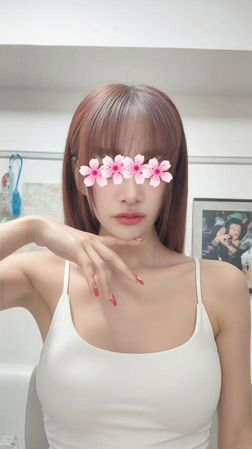 ポリちゃん（25才）